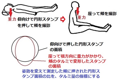 頬のタルミ測定法