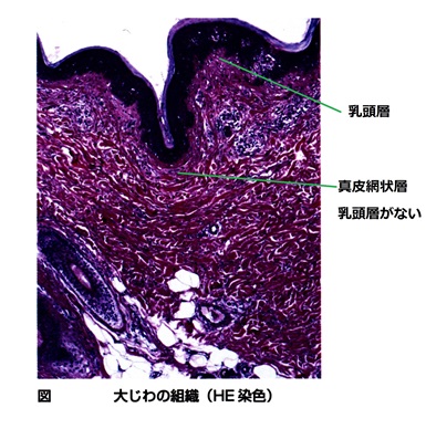 大ジワの組織の断面